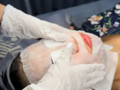 Liệu trình CO2 thải độc da